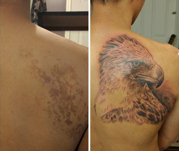 Illustration de l'article : 14 of the most beautiful tattoos to cover up birthmarks