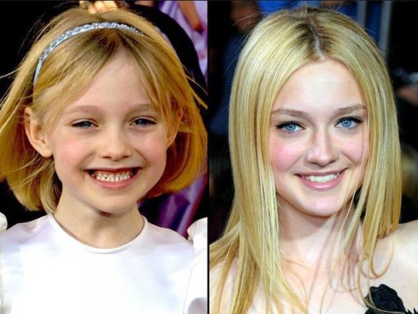 Illustration de l'article : 9 celebrities who have changed dramatically over the years