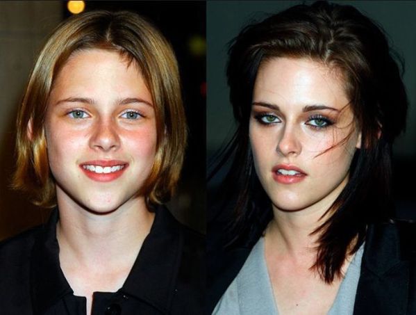 Illustration de l'article : 9 celebrities who have changed dramatically over the years