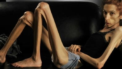 Illustration : In danger of dying at a weight of just 44 pounds, she takes control and it's impressive to see what she has become...