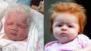 Illustration : "14 babies born with a lot of hair!"