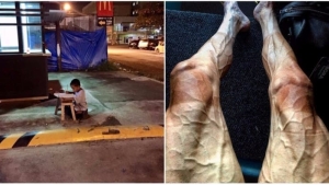 Illustration : "15 photos that show human strength and determination at its best"