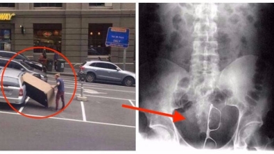 Illustration : "23 baffling photos that will make you wonder what's wrong with people"