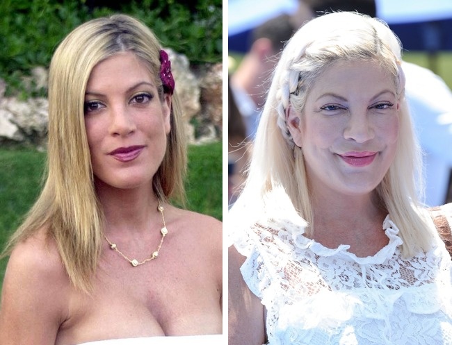 Illustration de l'article : 10 celebrities who are totally unrecognizable after having had cosmetic procedures