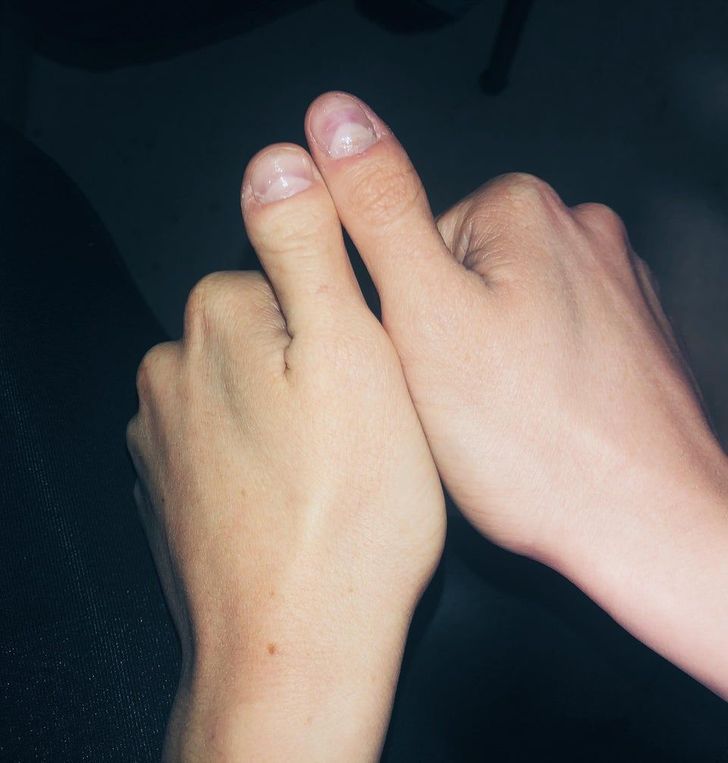 Illustration de l'article : 20 people with striking physical traits