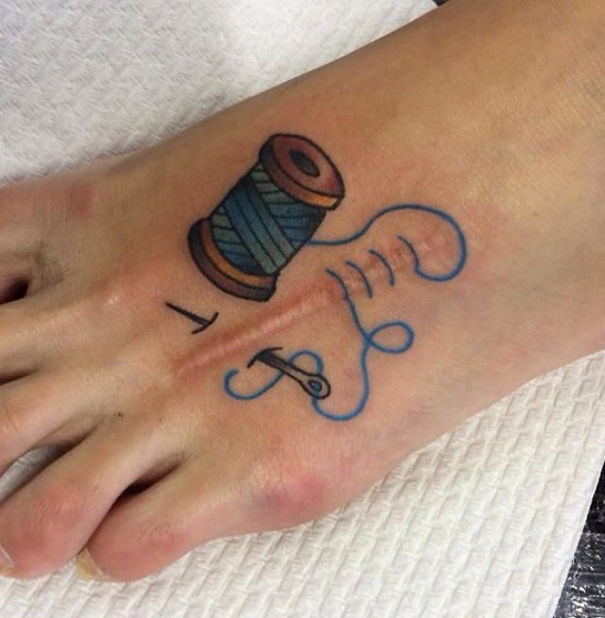 Illustration de l'article : 30 amazing tattoos that turn scars into works of art