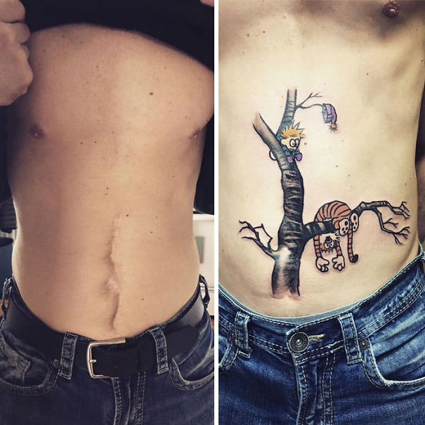 Illustration de l'article : 30 amazing tattoos that turn scars into works of art