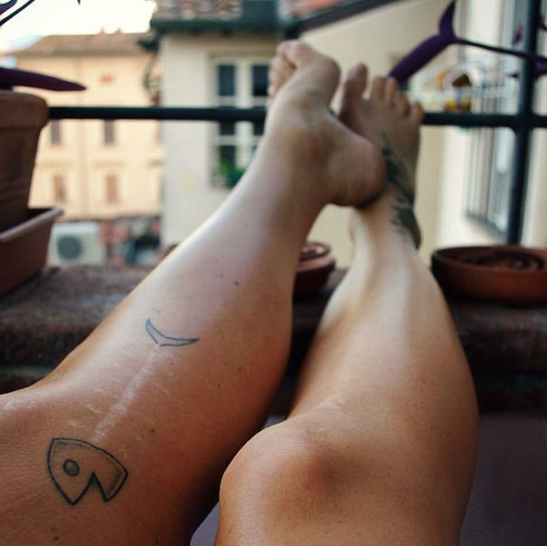 Illustration de l'article : 30 amazing tattoos that turn scars into works of art