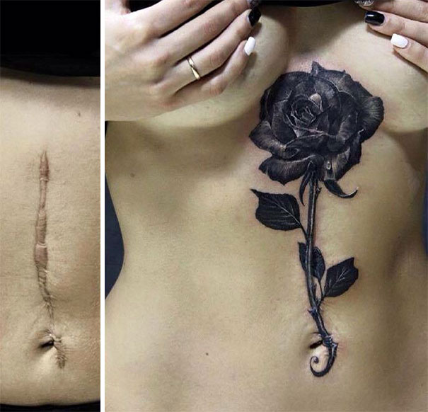 Illustration de l'article : 30 amazing tattoos that turn scars into works of art