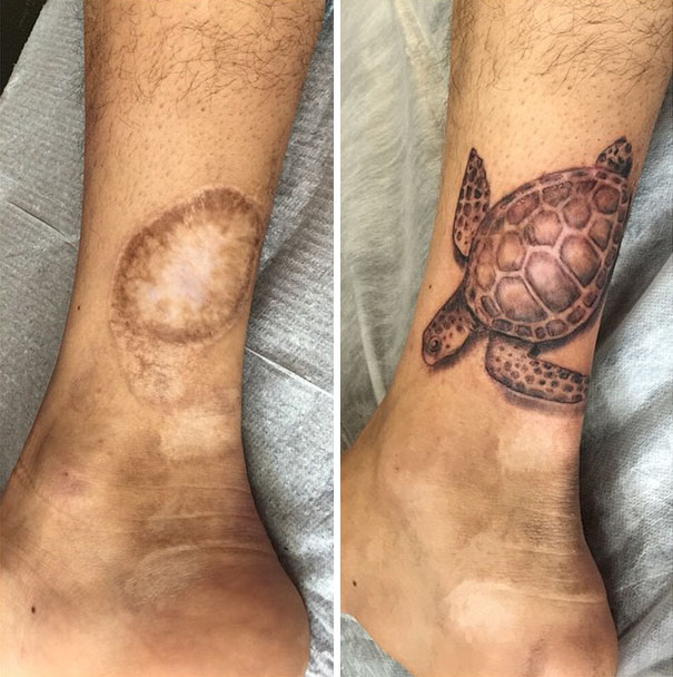 Illustration de l'article : 30 amazing tattoos that turn scars into works of art