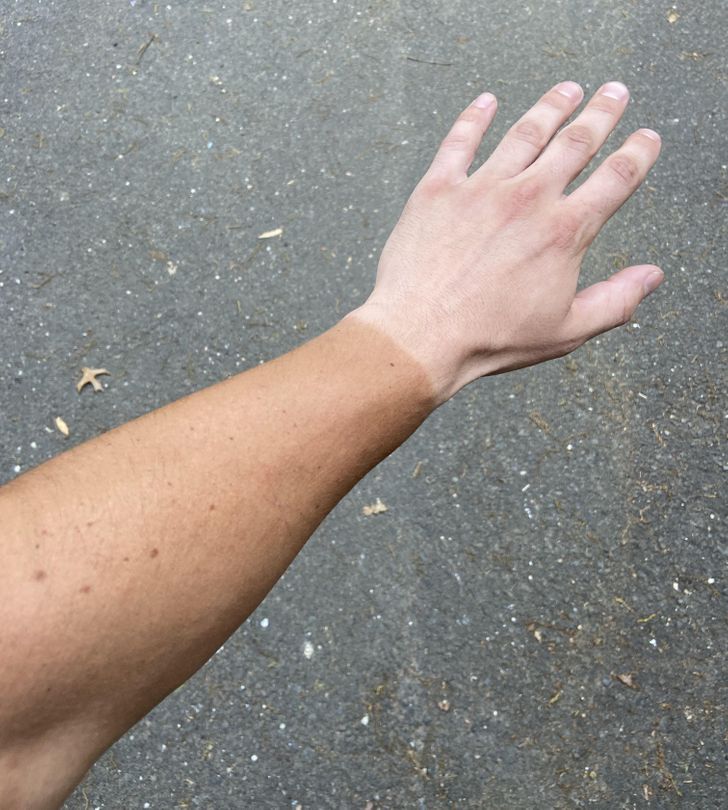 Illustration de l'article : 20 people who snapped and shared a nasty surprise