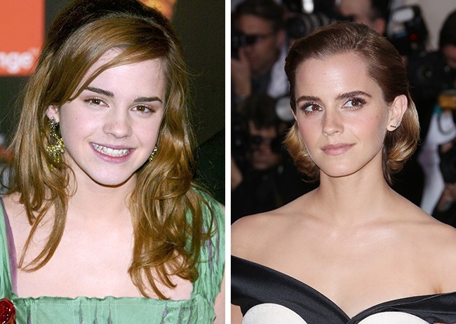 Illustration de l'article : 15 celebrities restyled by Hollywood: before and after photos
