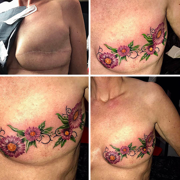 Illustration de l'article : 30 amazing tattoos that turn scars into works of art
