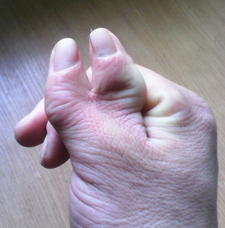 Illustration de l'article : 18 photos of unusual physical traits and natural wonders