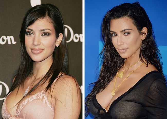 Illustration de l'article : 15 celebrities restyled by Hollywood: before and after photos