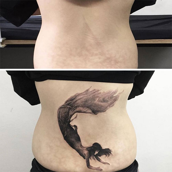 Illustration de l'article : 30 amazing tattoos that turn scars into works of art