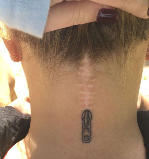 Illustration de l'article : 30 amazing tattoos that turn scars into works of art