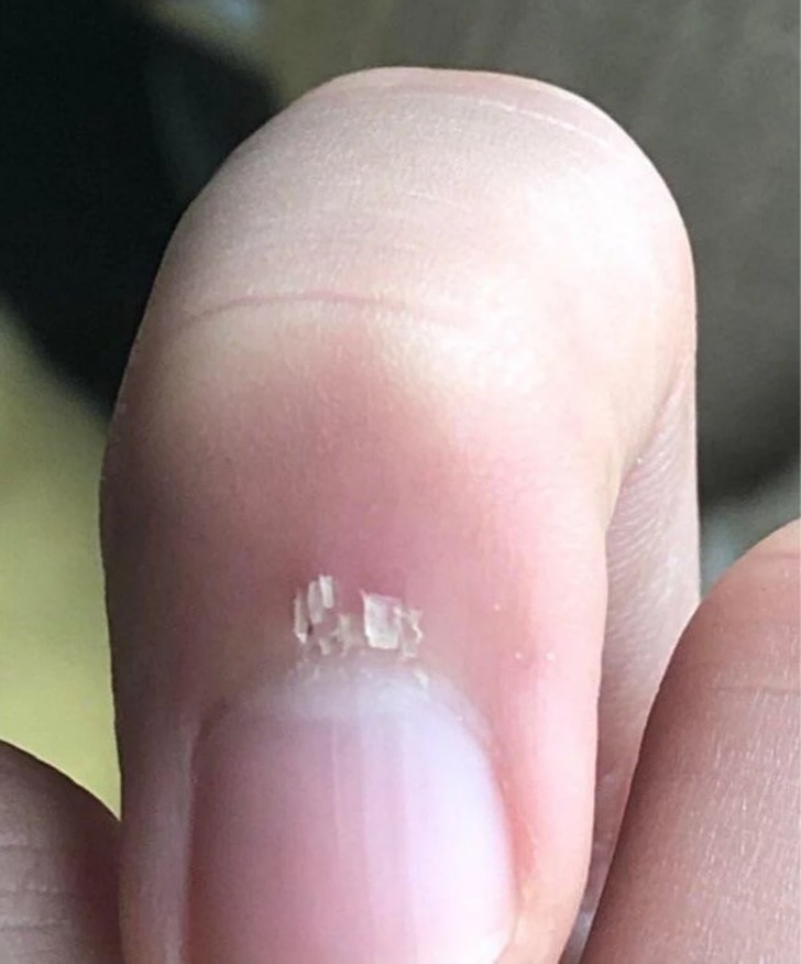 Illustration de l'article : 13 truly exasperating situations caught on camera