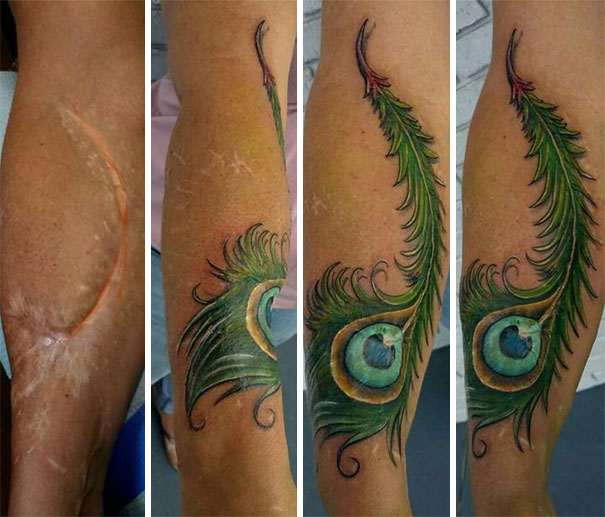 Illustration de l'article : 30 amazing tattoos that turn scars into works of art
