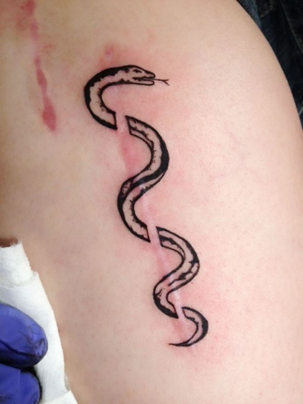Illustration de l'article : 30 amazing tattoos that turn scars into works of art