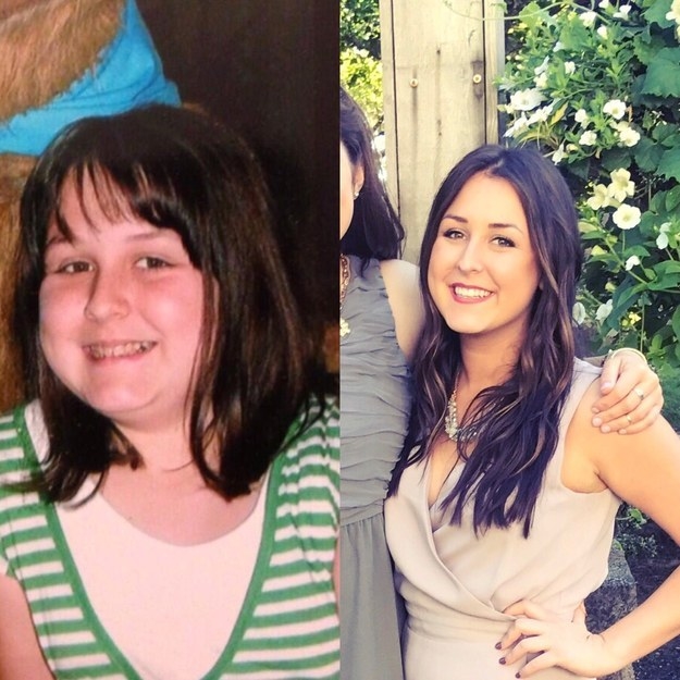 Illustration de l'article : 36 remarkable photos of people who blossomed once they passed puberty