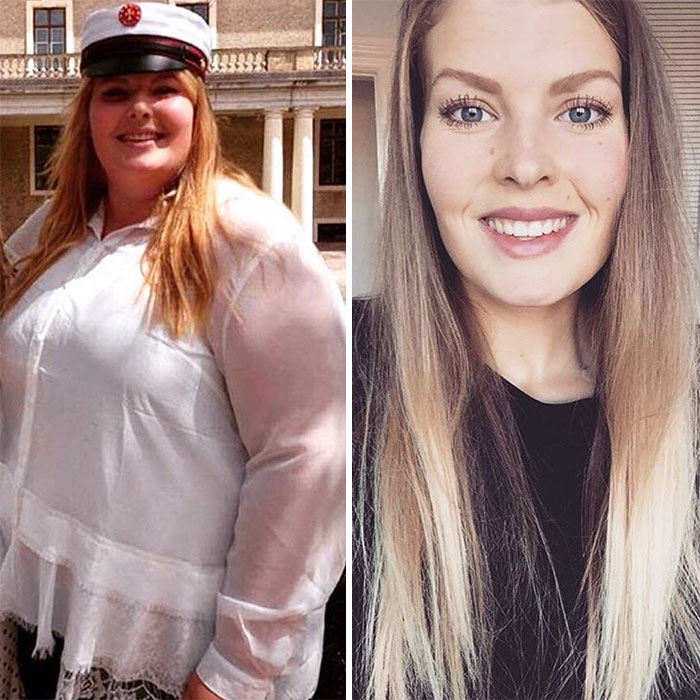 Illustration de l'article : 20 unbelievable before-and-after weight loss photos