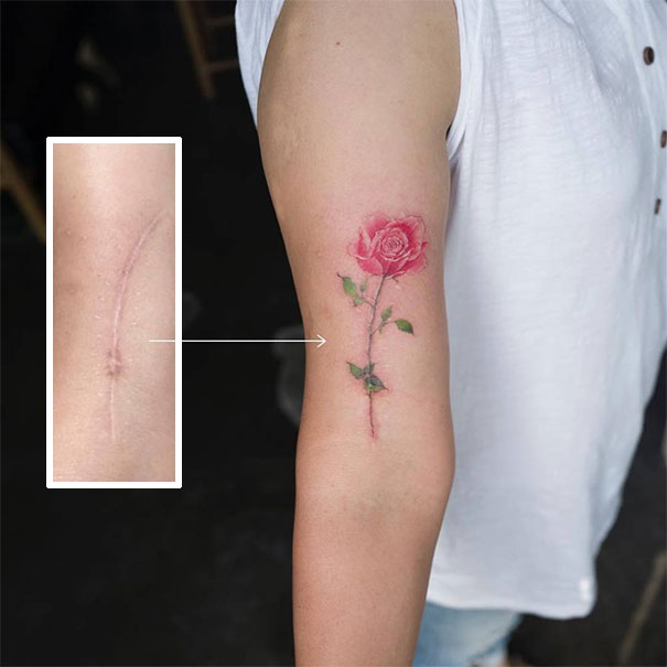 Illustration de l'article : 30 amazing tattoos that turn scars into works of art