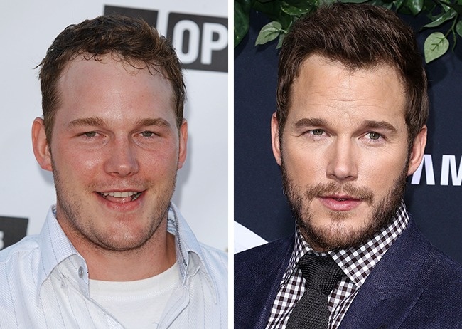 Illustration de l'article : 15 celebrities restyled by Hollywood: before and after photos