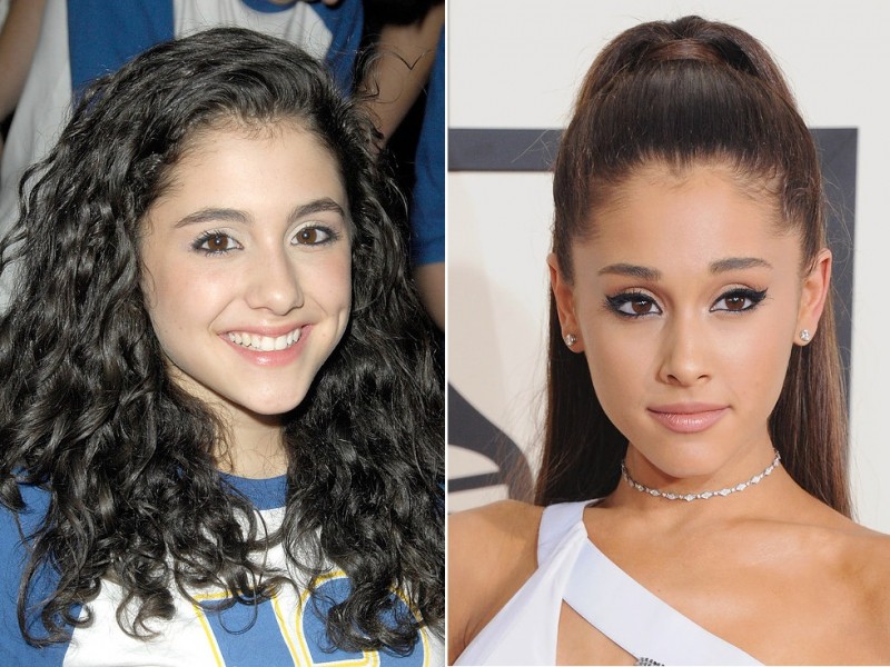 Illustration de l'article : The 16 most unbelievable celebrity changes in just 9 years