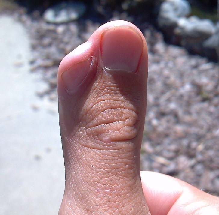 Illustration de l'article : 18 photos of unusual physical traits and natural wonders