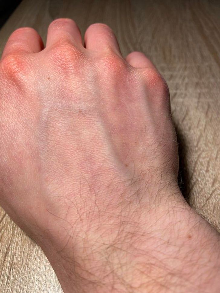 Illustration de l'article : 20 people with striking physical traits