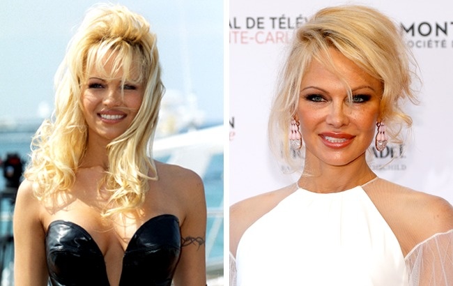 Illustration de l'article : 12 celebrities whose lifestyles took a toll on their looks