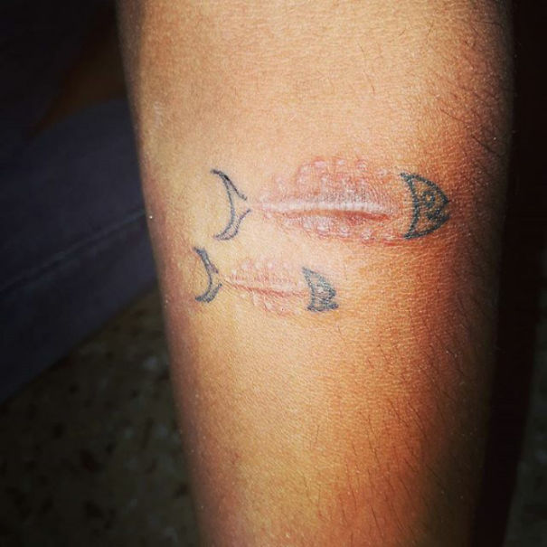 Illustration de l'article : 30 amazing tattoos that turn scars into works of art