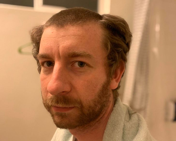 Illustration de l'article : 20 people who snapped and shared a nasty surprise