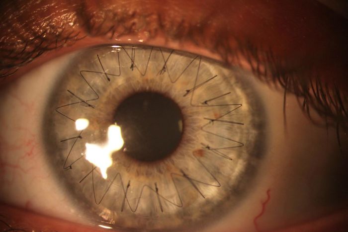 Illustration de l'article : 20 impressive photos reveal the hidden side of things