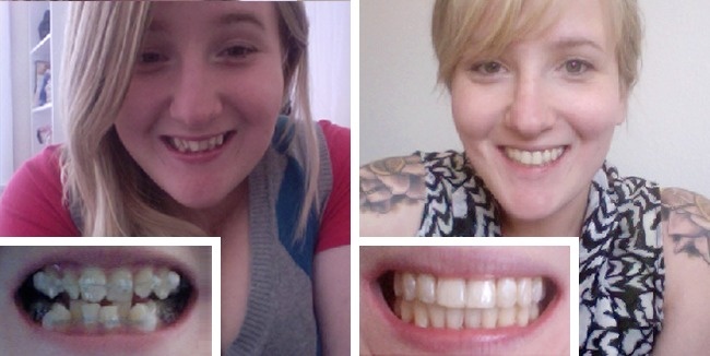 Illustration de l'article : 26 inspiring people who totally turned their lives around