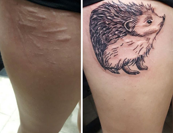 Illustration de l'article : 30 amazing tattoos that turn scars into works of art