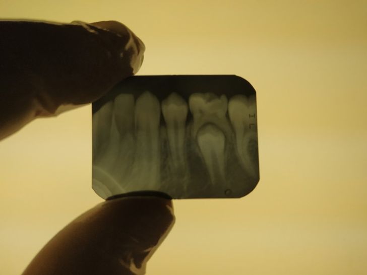 Illustration de l'article : 14 X-ray images that reveal a hidden story