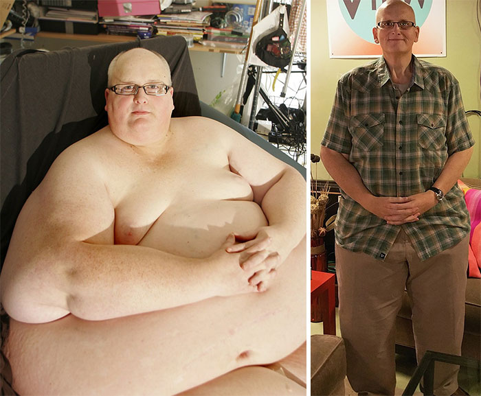 Illustration de l'article : 20 unbelievable before-and-after weight loss photos
