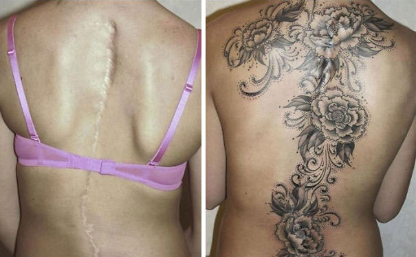 Illustration de l'article : 30 amazing tattoos that turn scars into works of art