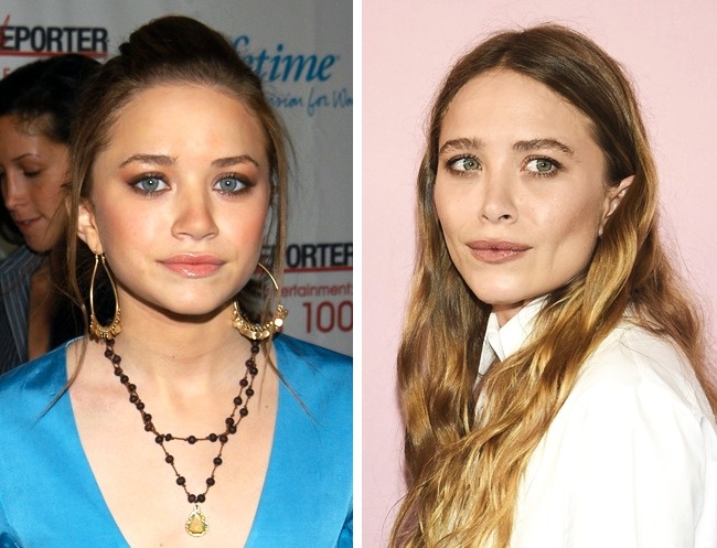 Illustration de l'article : 10 celebrities who are totally unrecognizable after having had cosmetic procedures