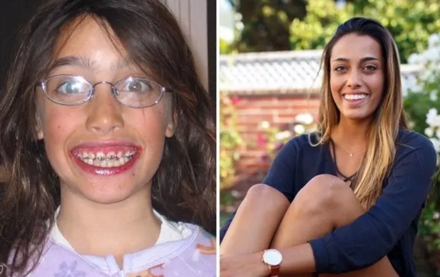 Illustration de l'article : 36 remarkable photos of people who blossomed once they passed puberty