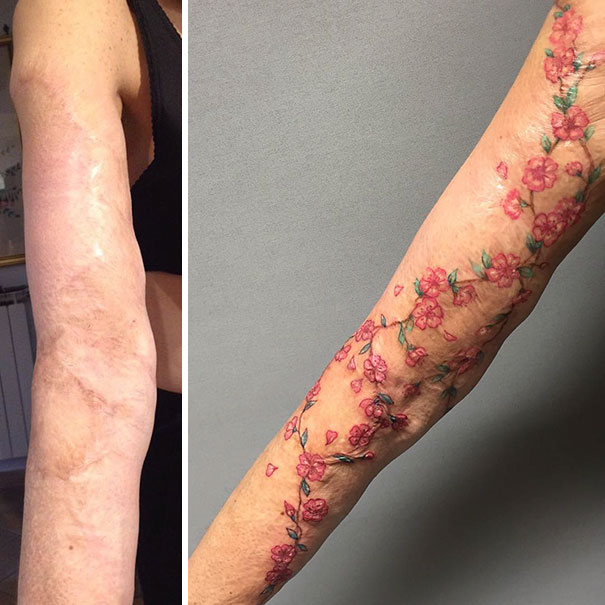 Illustration de l'article : 30 amazing tattoos that turn scars into works of art