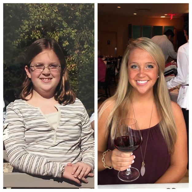 Illustration de l'article : 36 remarkable photos of people who blossomed once they passed puberty