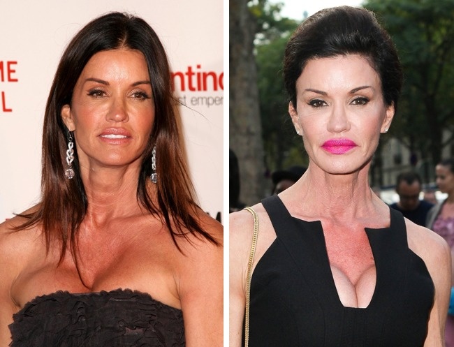 Illustration de l'article : 10 celebrities who are totally unrecognizable after having had cosmetic procedures
