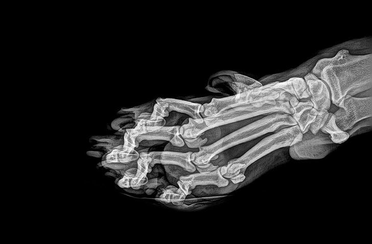 Illustration de l'article : 14 X-ray images that reveal a hidden story