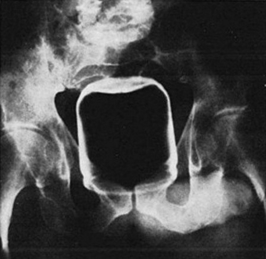 Illustration de l'article : Doctors reveal 17 bizarre objects that they had to remove from their patients’ genitals...