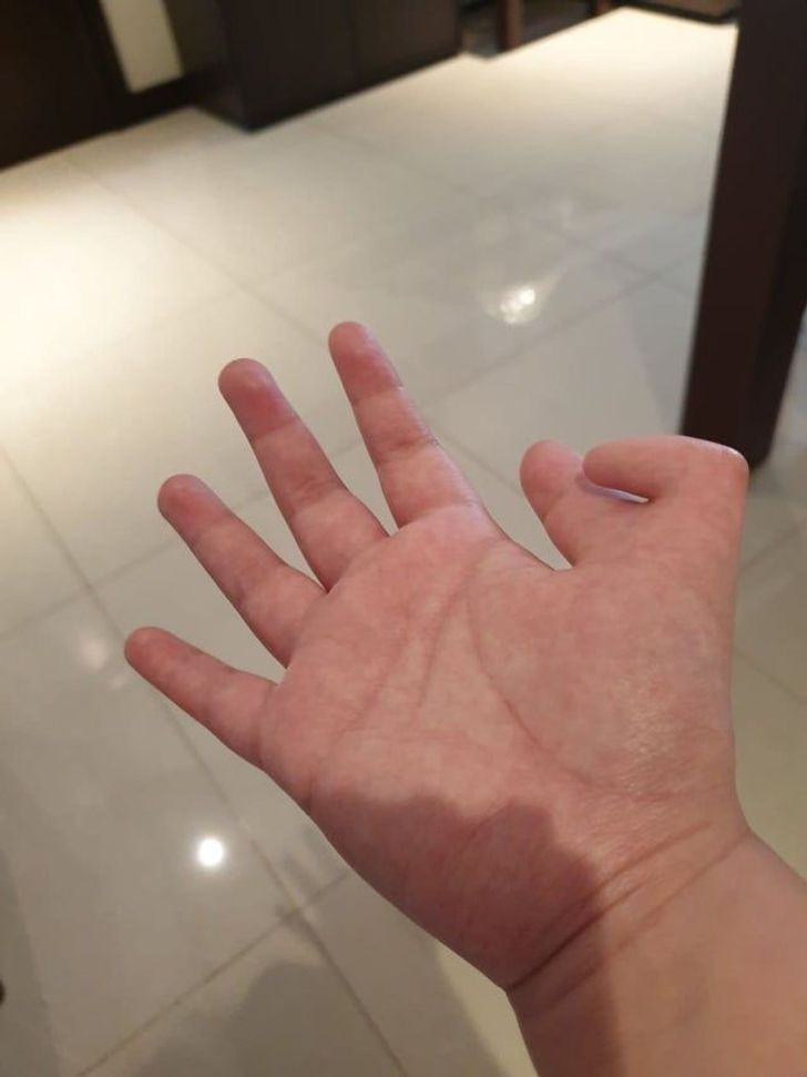 Illustration de l'article : 20 people with striking physical traits