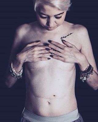 Illustration de l'article : They removed her intestine when she was 16, and today the photos of her body and her project touch everyone!
