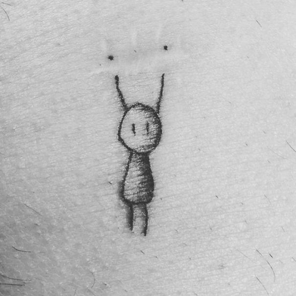 Illustration de l'article : 30 amazing tattoos that turn scars into works of art